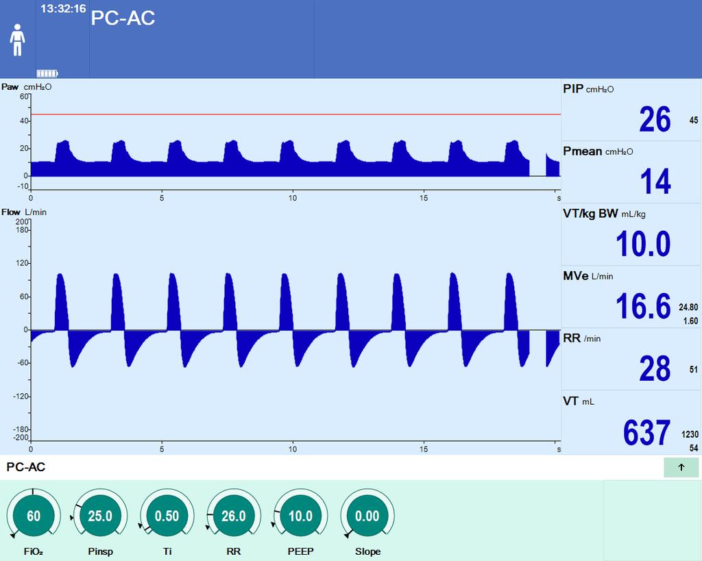 Assessment of inspiratory dysynchrony in AC-PC Rounded