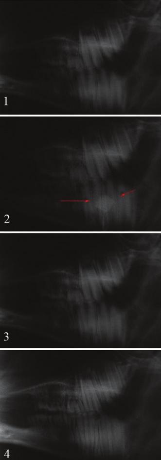 74 MH Aras et al Table 3 Image quality of foreign bodies in various regions observed via conventional plain radiography Conventional plain on bone in muscle in air