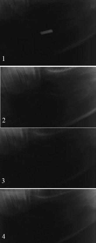 76 MH Aras et al a b c Figure 3 of foreign body in air. (a) Conventional plain radiography. (b) CT. (c) Ultrasonography. 1, metal; 2, dry wood; 3, graphite; 4, Bakelite.