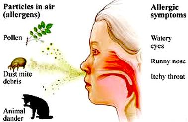 Condition which cause nasal congestion: Common cold: Symptoms usually start 2 to 3 days after initial contact with the virus and symptoms affect mainly the nose, e.g. nasal congestion, runny nose, scratchy throat and sneezing.