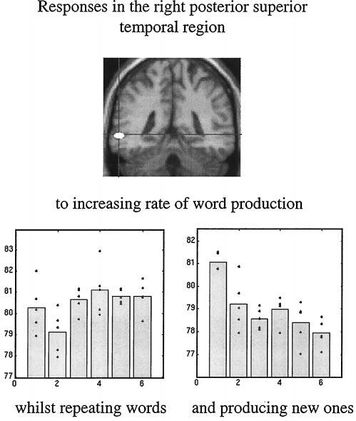 802 Colloquium Paper: Friston Proc. Natl. Acad. Sci. USA 95 (1998) non-word-like letter strings. If this were the case, should the extrastriate area be designated a word-form area?