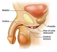 Urethra Urine exits the body through the urethra.