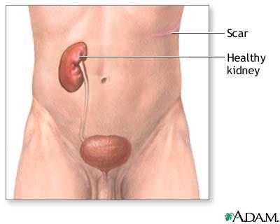 Kidneys The human body can function with only 1 kidney.