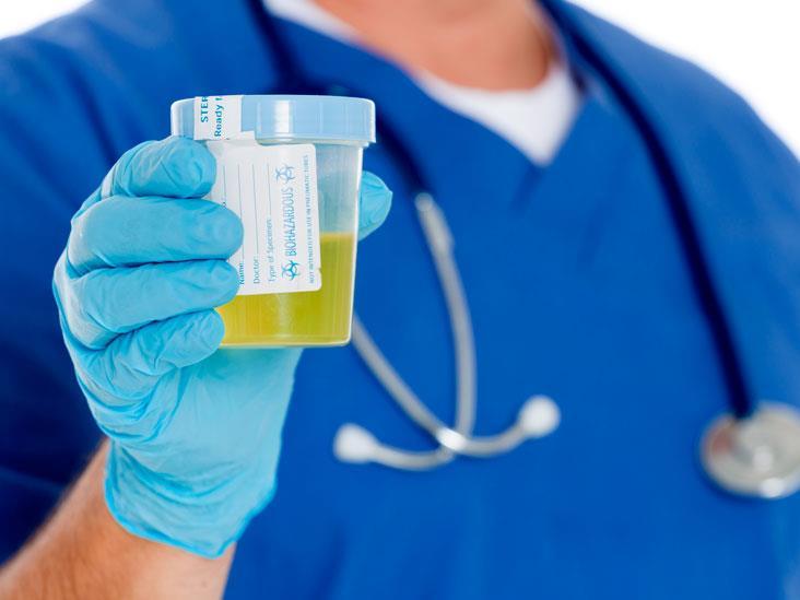 Why do we give urine samples when we visit the doctor for a physical examination?