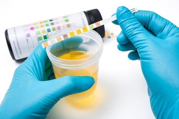 Urinalysis A test of your urine s physical and chemical properties Indicator of overall health Used to detect a wide range of disorders: UTIs