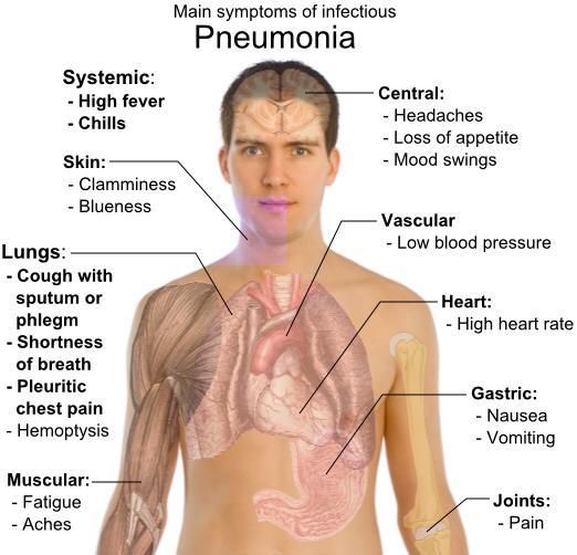 Register to book your appointments online Pneumonia vaccine The pneumonia vaccine protects against pneumococcal infections. A pneumonia infection can affect anyone.