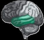 Temporal Lobes Responsible for hearing, memory, emotional