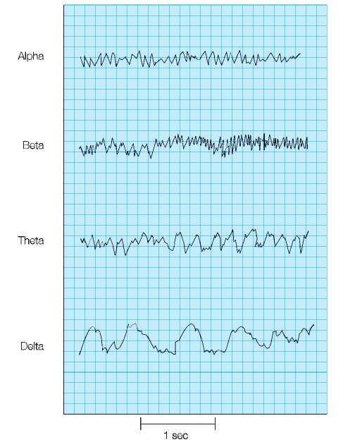 TYPES OF WAVES IN EEG Alpha waves are best recorded from the parietal and occipital regions while a person is awake and relaxed but with the eyes closed.