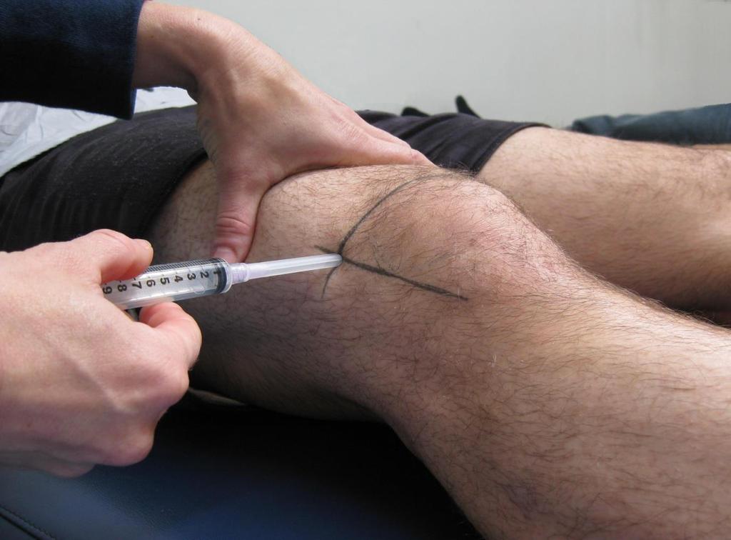of these lines with needle