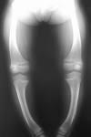X-ray in