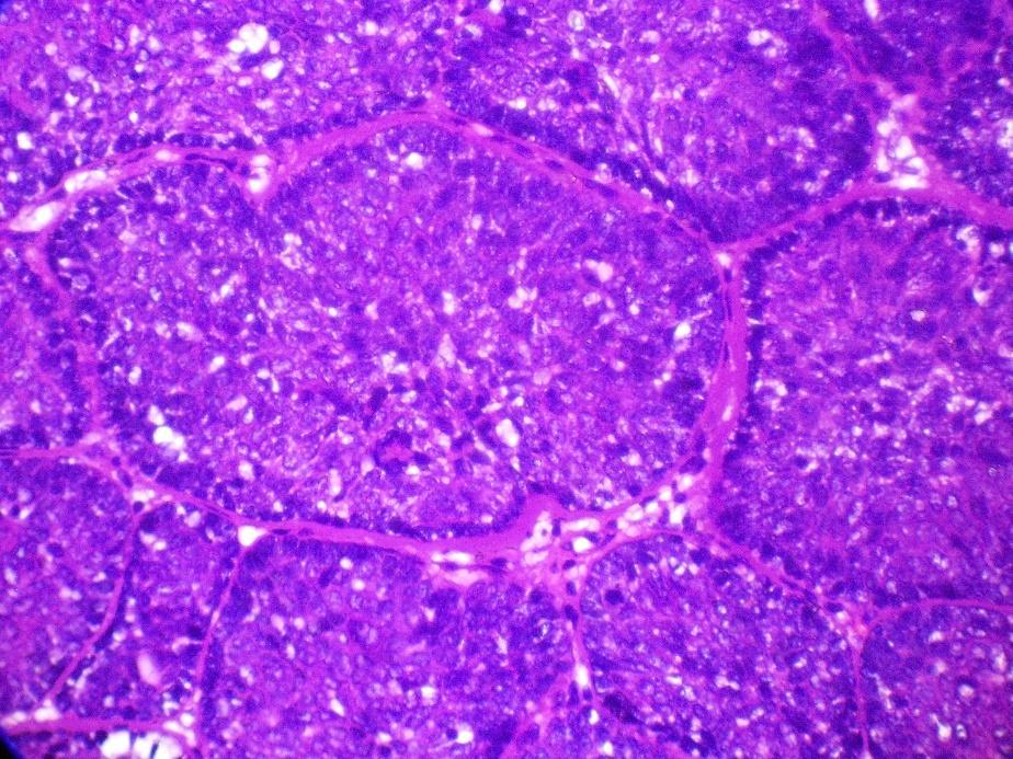 Figure 4: H&E Stained 40x Dark staining