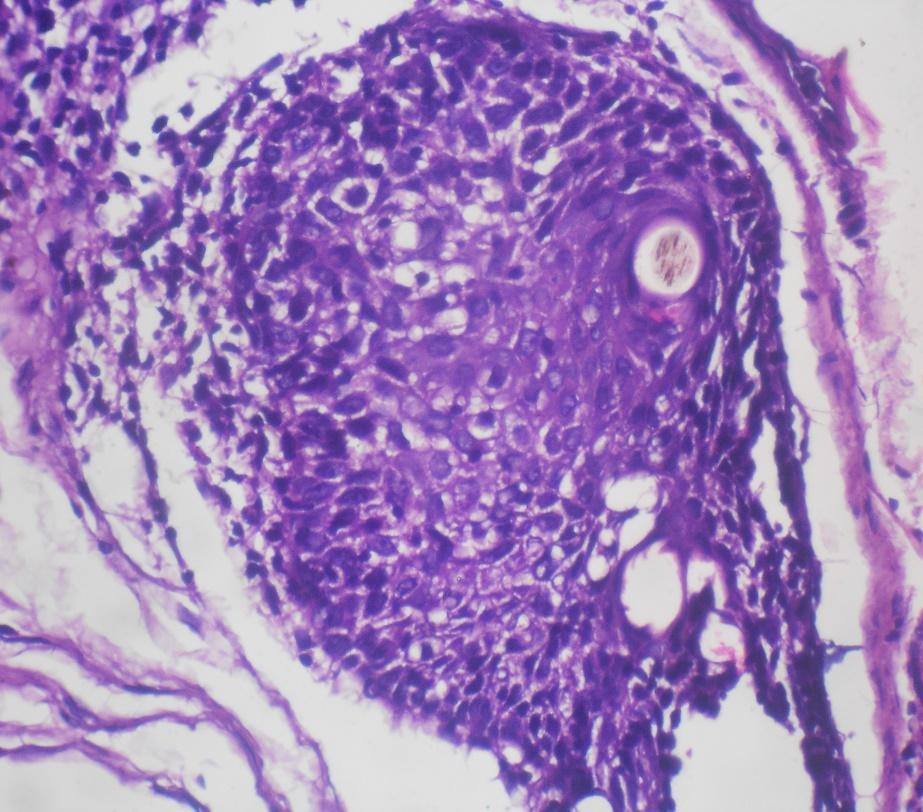 Figure 10: H&E Stained 10x Abortive hair