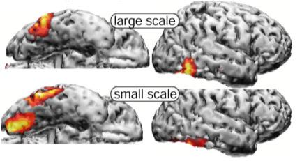 large patters had differential effects on cortical