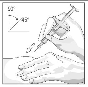 Figure 18 With a quick, short motion, push the needle all the way into the skin. With your free hand, slowly push the plunger to inject solution (Figure 19).