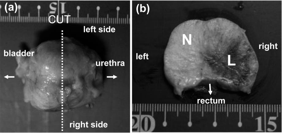 842 K. SASAKI ET AL. Fig. 3. (a) Ventral view of prostate (fixed with 10% formalin) of a dog sacrificed immediately after HIFU ablation.