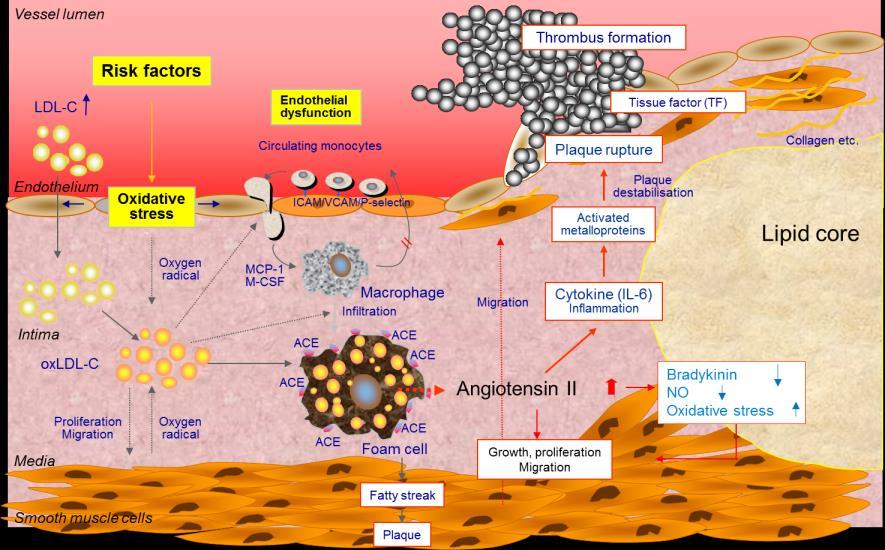 Pathophysiology: LDL-Cholesterol CAUSES