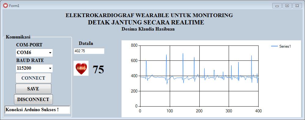 Figure 6: Snapshot of the GUI TABLE I HEART RATE (I BPM) CALCULATED BY ECG PROTYPE (FILTER-BASED ALGORITHM) AD KIETIC TM.