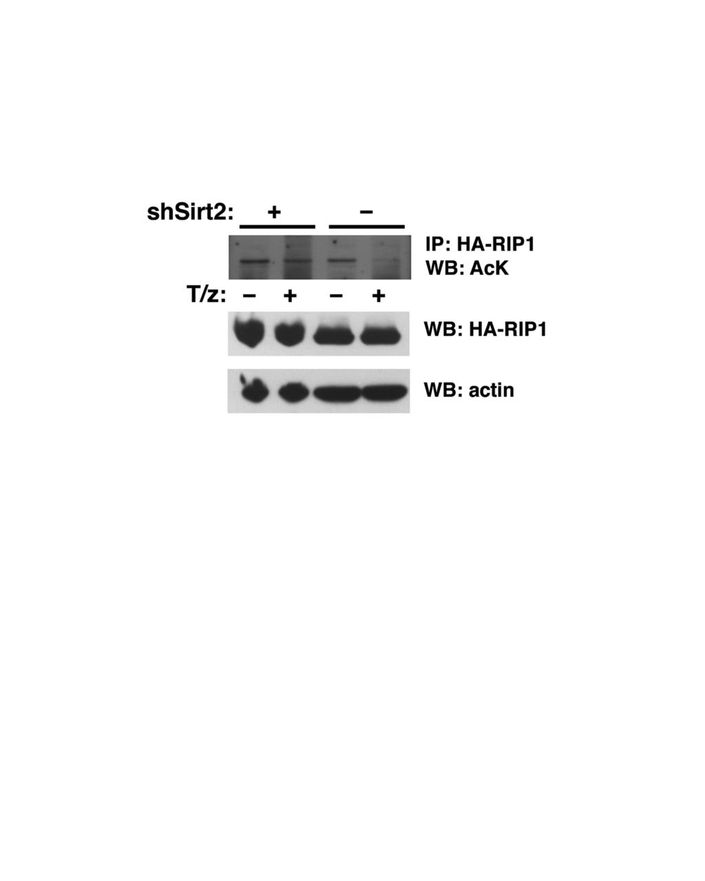 Figure 6: Assessment of RIP1 acetylation. Reverse procedure for detecting RIP1 acetylation using immunoprecipitation of RIP1 followed by Western blotting using an acetyl-lysine antibody (AcK).