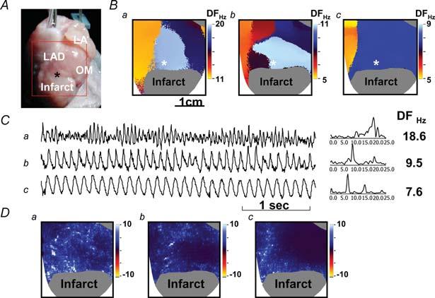 904 C-C. Chou and others J Physiol 580.3 at these sites. During ventricular fibrillation, transient regional Ca i elevations often preceded wavebreak in the peri-infarct zone.