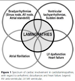 CARDIAC INVOLVEMENT : DCM ± ARRHYTHMIC DISORDERS Progression of age-related phenotypes in LMNA