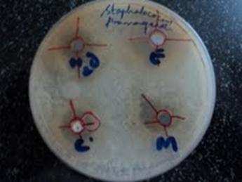 Results for the Antimicrobial testing: Fig 1 and 2 showing the obtained for various test sampl Fig 6: The figure shows the zones of inhibition for the pomegranate extracts against the Staphylococcus