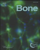 BON-09329; No. of pages: 7; 4C: Bone xxx (2011) xxx xxx Contents lists available at ScienceDirect Bone journal homepage: www.elsevier.