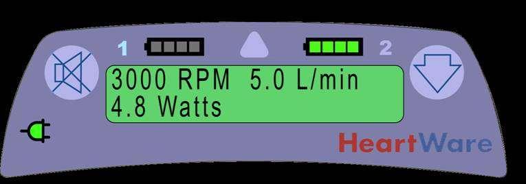 HeartWare Controller Display Alarm Indicator Power Source 1 Battery Indicator 1 Battery