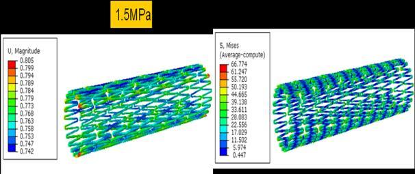 Von-mises in MPa Radial in mm 1 0.8 Fig.6 and stresses for PEEK 450G at different pressure load cases 0.6 0.4 0.2 0 0.5 1 1.5 Pressure in MPa PEEK450G Mg AZ31 Co-Cr L605 TABLE.