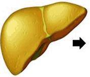 Non-Alcoholic Fatty Liver Disease (NAFLD) Clinical Progression Fatty liver is a reversible condition