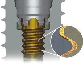 The Proprietary Gold-Tite Screw surface technology allows the screw to engage further, increasing the clamping force by up to 113 %, compared to standard screws 9, thereby maximizing the abutment
