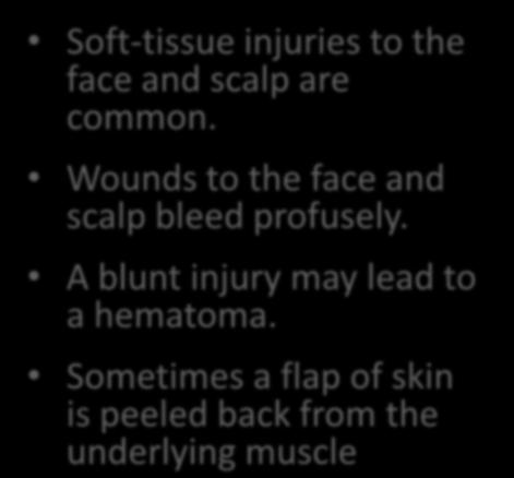 Soft-Tissue Injuries Soft-tissue injuries to the face