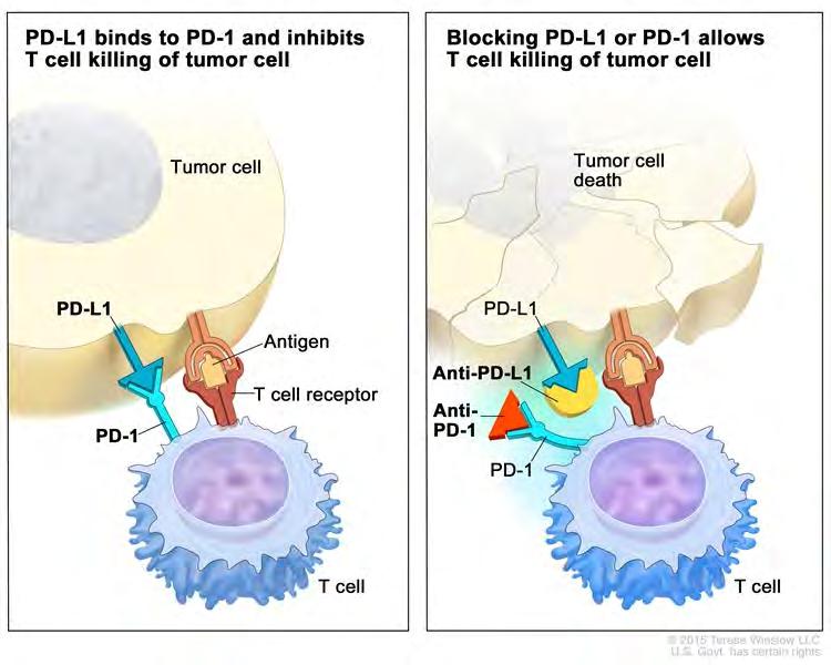 Immunotherapy Drug Development Checkpoint inhibitors (PD-1/PD-L1, CTLA-4) Taking the brakes off the immune system Thought to be beneficial in tumors with high expression of PD- L1 or