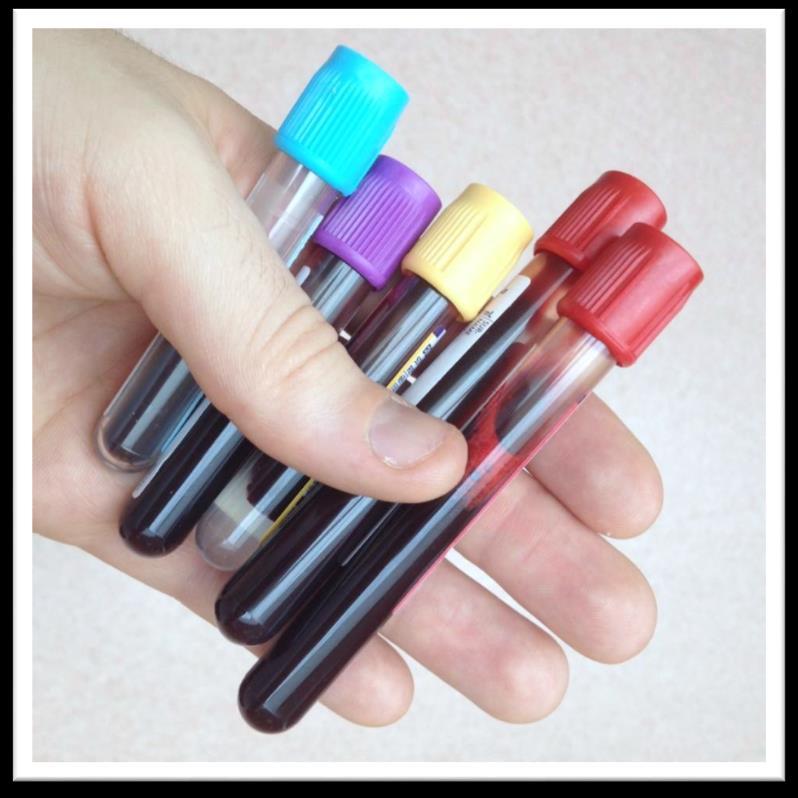 Toxicology testing Specimens from deceased road user (blood, urine, etc.