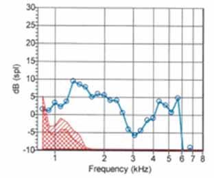 Figure 4a. Distortion product otoacoustic emissions (DPOAEs) demonstrating present responses at 1.4 khz through 6 khz in the right ear and at 1.4 khz through 2.8 khz in the left ear. Figure 4b.