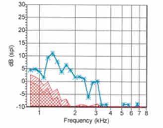 Hearing Aid Assessment An electroacoustic analysis of the patient s hearing aid revealed it to be functioning within the manufacturer s specifications.