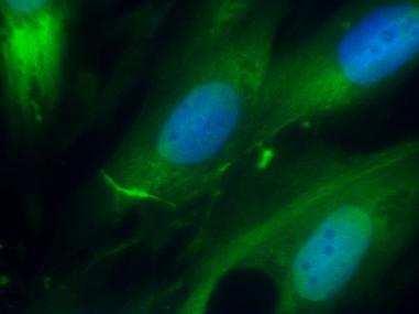 mrker (green) in H9c cells untreted (A) or