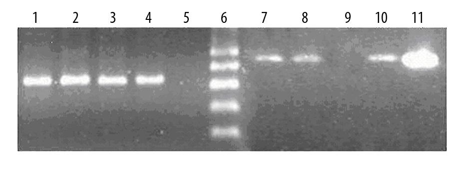 The 445-bp PCR product was analyzed by electrophoresis on 2% agarose gel. The amplification was performed in the GeneAmp PCR System 2700 Thermal cycler (Applied Biosystem).