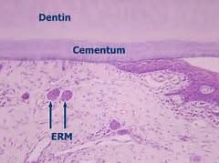 Dentinogenesis imperfect: Disturbances in either the secretion or maturation of the dentin matrix can lead to defects in dentin structure, and consequently to the supportive function of dentin.