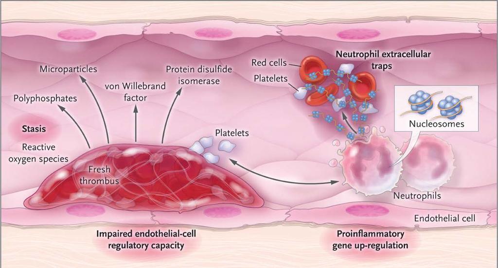 ASA and Prevention of VTE Venous thrombi: fibrin, platelets, red cells, leukocytes.