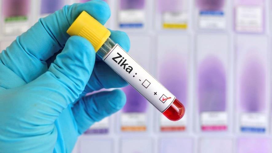 PDPH Zika Activities Epidemilgy & Surveillance Identificatin f cases Mnitring fr lng term health effects Crdinatin f labratry testing