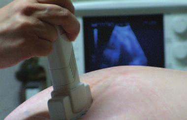 Since initial implementation, the use of emergency ultrasound has grown rapidly to include studies for both diagnostic purposes and procedural guidance.