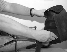 Purpose and benefits of the splint The aim of the splint is to ensure that the Achilles tendon