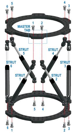 FRAME CONSTRUCTION Master Tab proximal and anterior ALWAYS on proximal ring Independent of reference ring 1 and 2 strut always must meet at