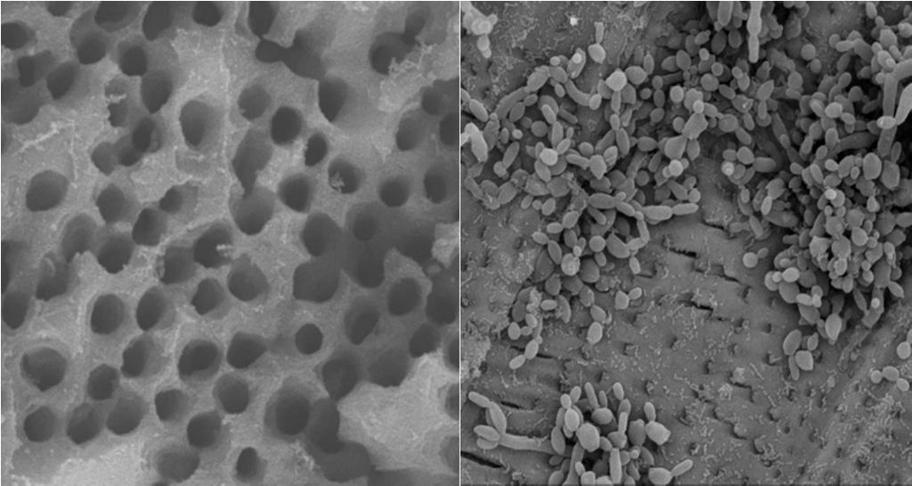 235 Awawdeh et al. Figure 1. A) Scanning electron microscope images of roots prepared for infection with Candida albicans.