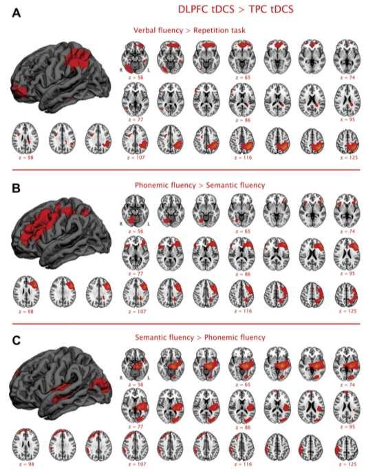 category cue after DLPFC tdcs compared to TPC stimulation Brain Stimulation, 2013 cognitive functions Significant changes of the BOLDresponse in favor of anodal tdcs over the