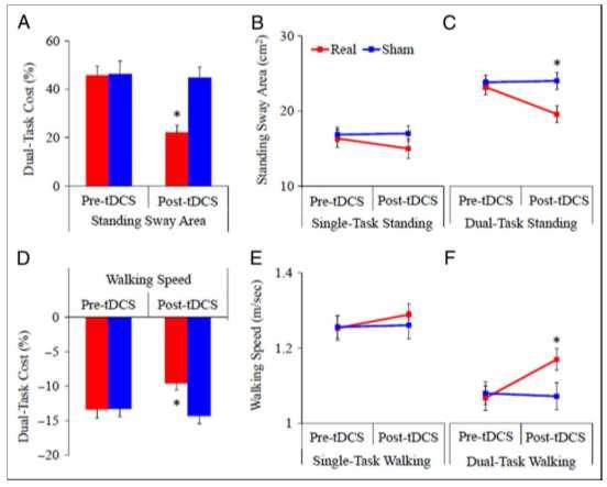 motor-cognitive functions The dual-task cost was defined by the percent change in postural sway area between single- and dual-task conditions.