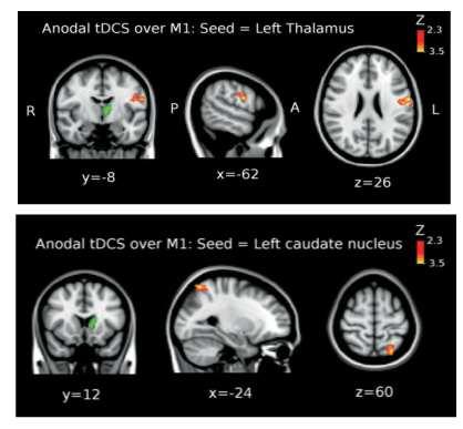 motor functions Why tdcs to improve motor functions?