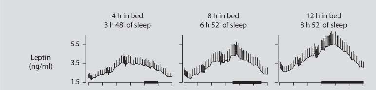 Short sleep lowers leptin