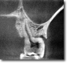 Conventional (medical) CT has