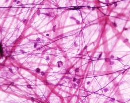 elastic fiber collagen fiber fibroblast Loose fibrous tissue is found supporting epithelium and many internal organs.